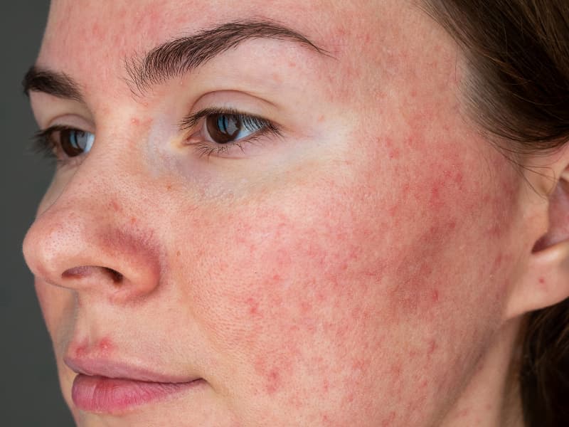 Why Your Body Reacts to Things That Shouldn’t Be a Big Deal related article image